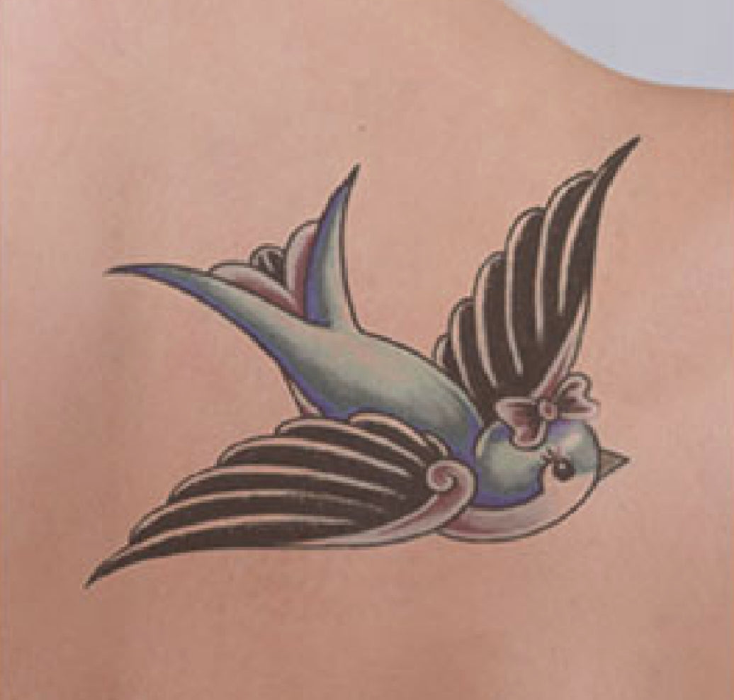 Tatoo removal before