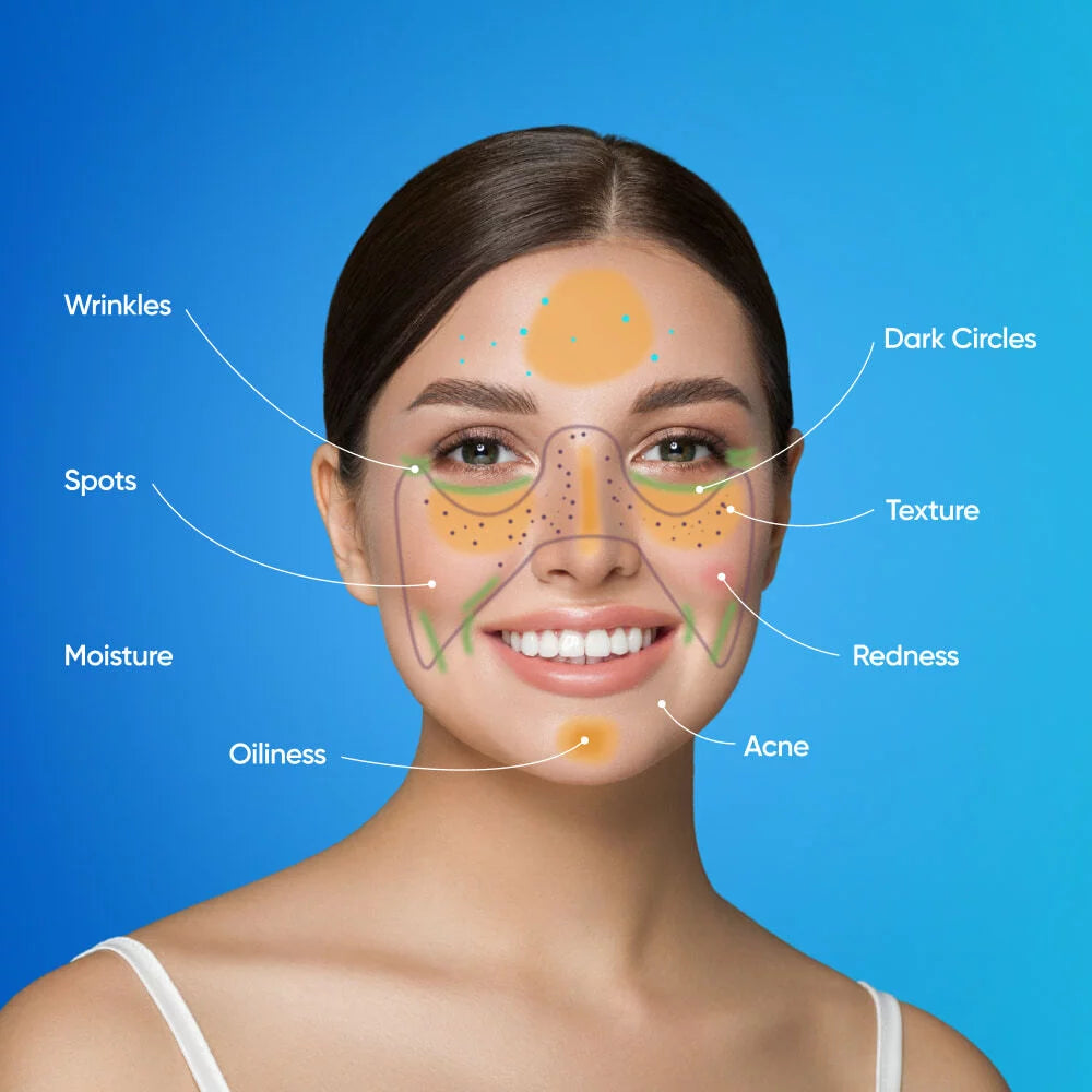 Skin conditions