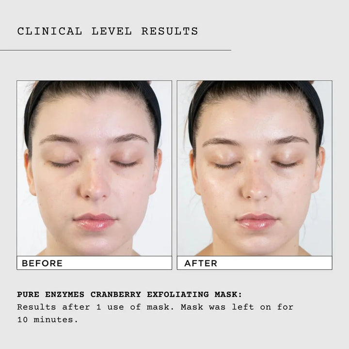 Pure Enzymes Exfoliating Mask 60 ml – CosMedix